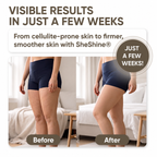 SheShine's Anti Cellulite Massager